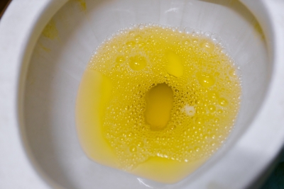 urine yellow color odor taking why supplements