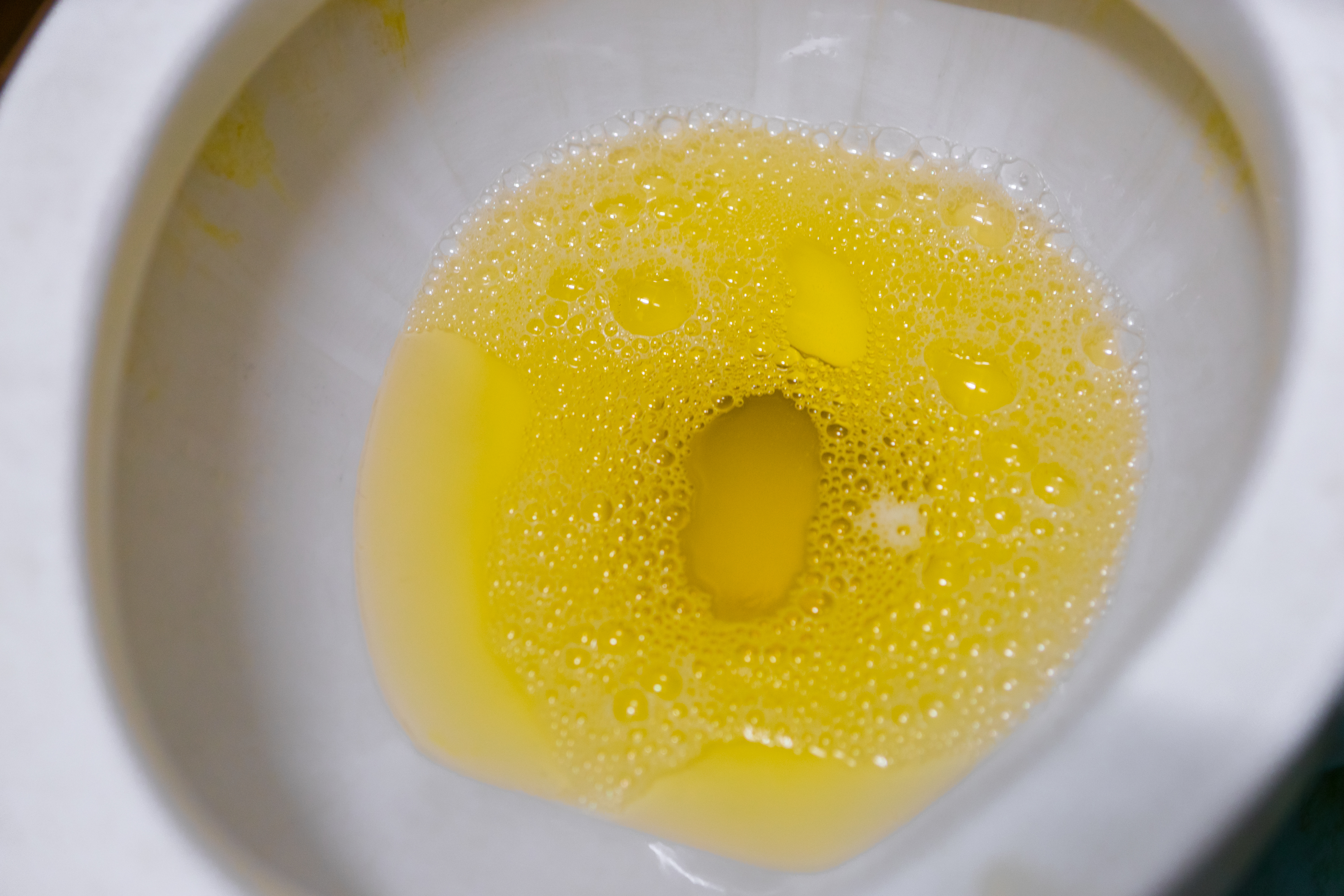 red particles in urine